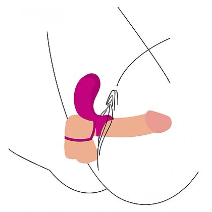 Inel Dublă Stimulare Couples Stimulator Ring Fuchsia 6